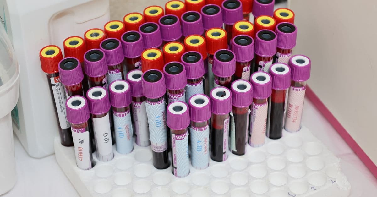 Does a GLP-1 show up in blood work? What it does and doesn't affect