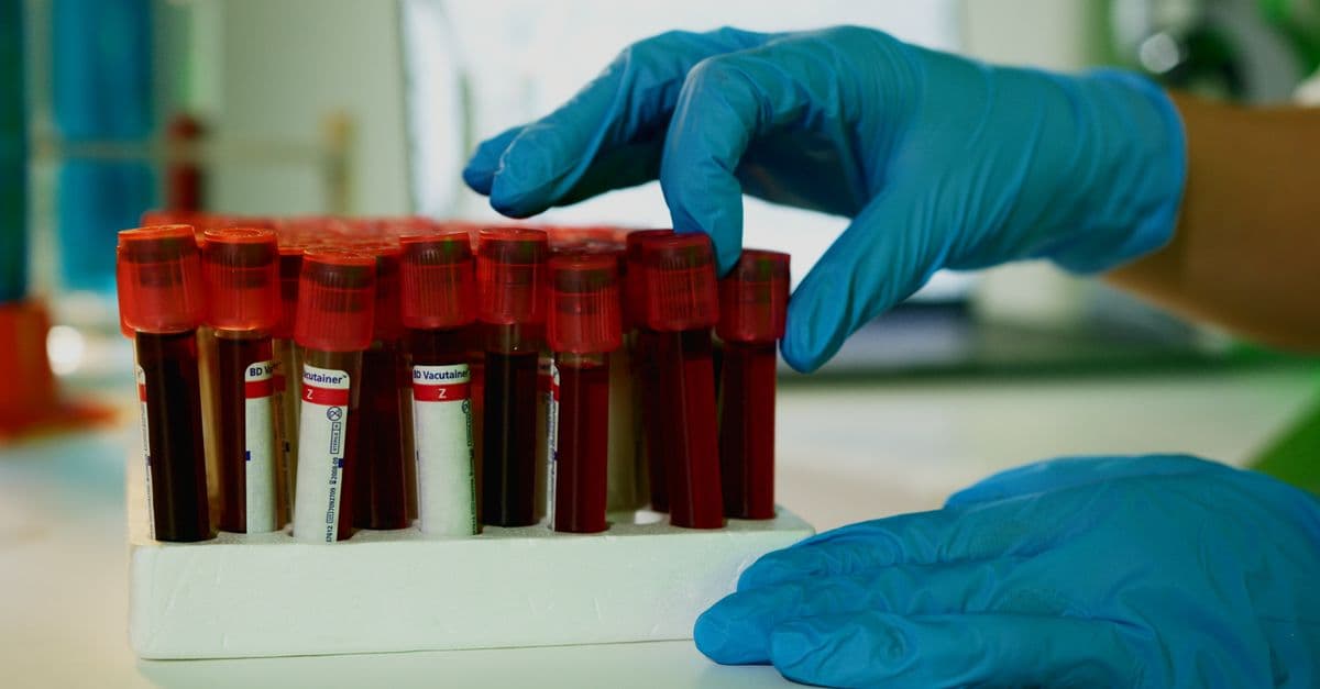 Does a GLP-1 show up in blood work? What it does and doesn't affect