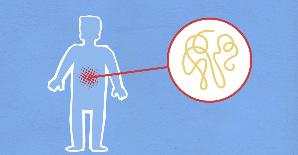 GLP-1 and gastroparesis: what the stomach-paralysis concern means